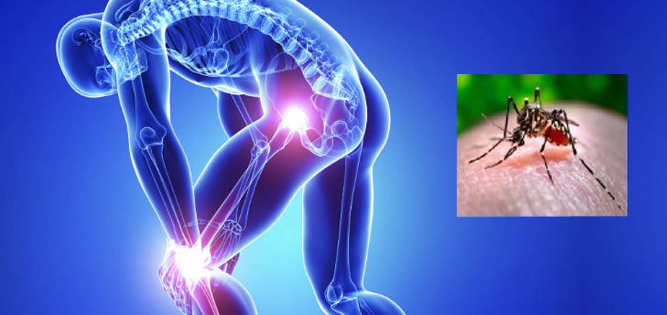 Chikungunya Symptoms, Causes, Prevention and Treatment